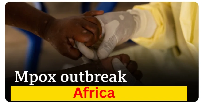 mpox outbreak africa