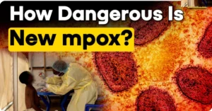 Mpox outbreak africa